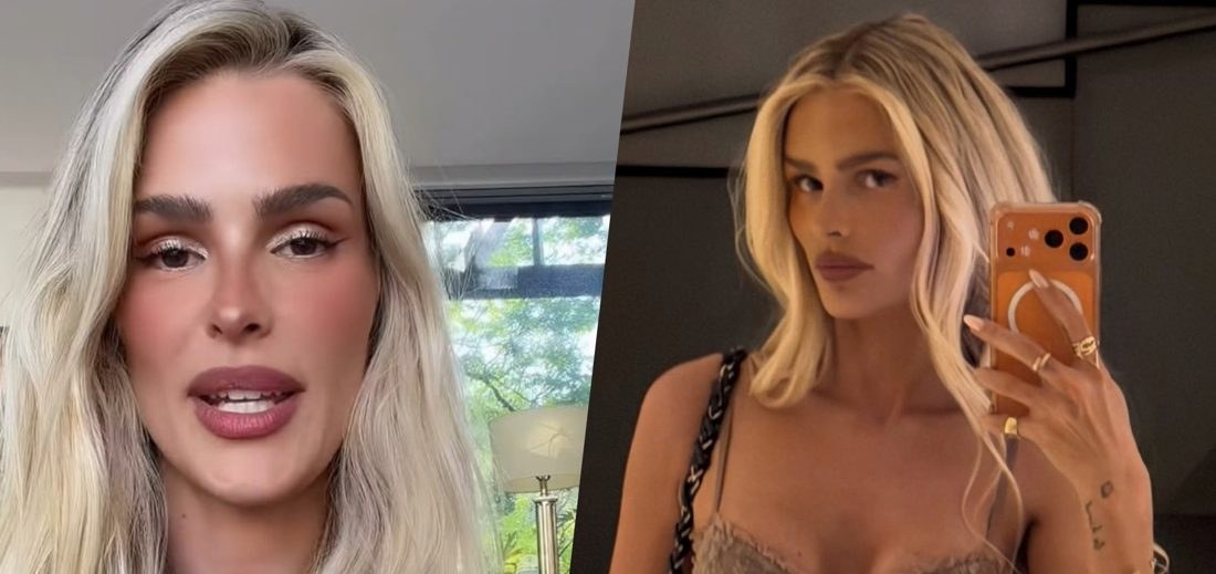Yasmin Brunet revela proibições e cuidados essenciais para conviver com o lipedema