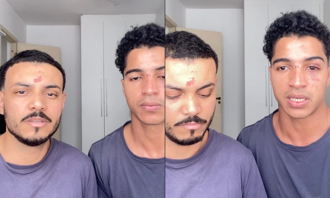 Estudante e modelo denunciam agressão homofóbica dentro de prédio da UFRJ após festa "Pizzada"