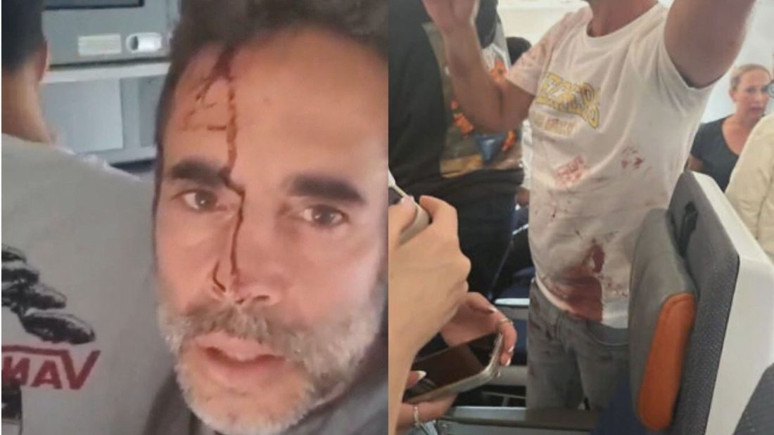 Passageiro sangrando e pilotos feridos são vistos em vídeo de voo FlyDubai desviado após tentativa de ataque
